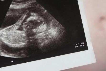 Нижегородка смогла родить ребенка почти при полном отсутствии яичников