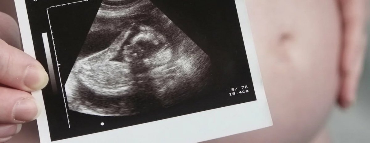 Нижегородка смогла родить ребенка почти при полном отсутствии яичников - фото 1